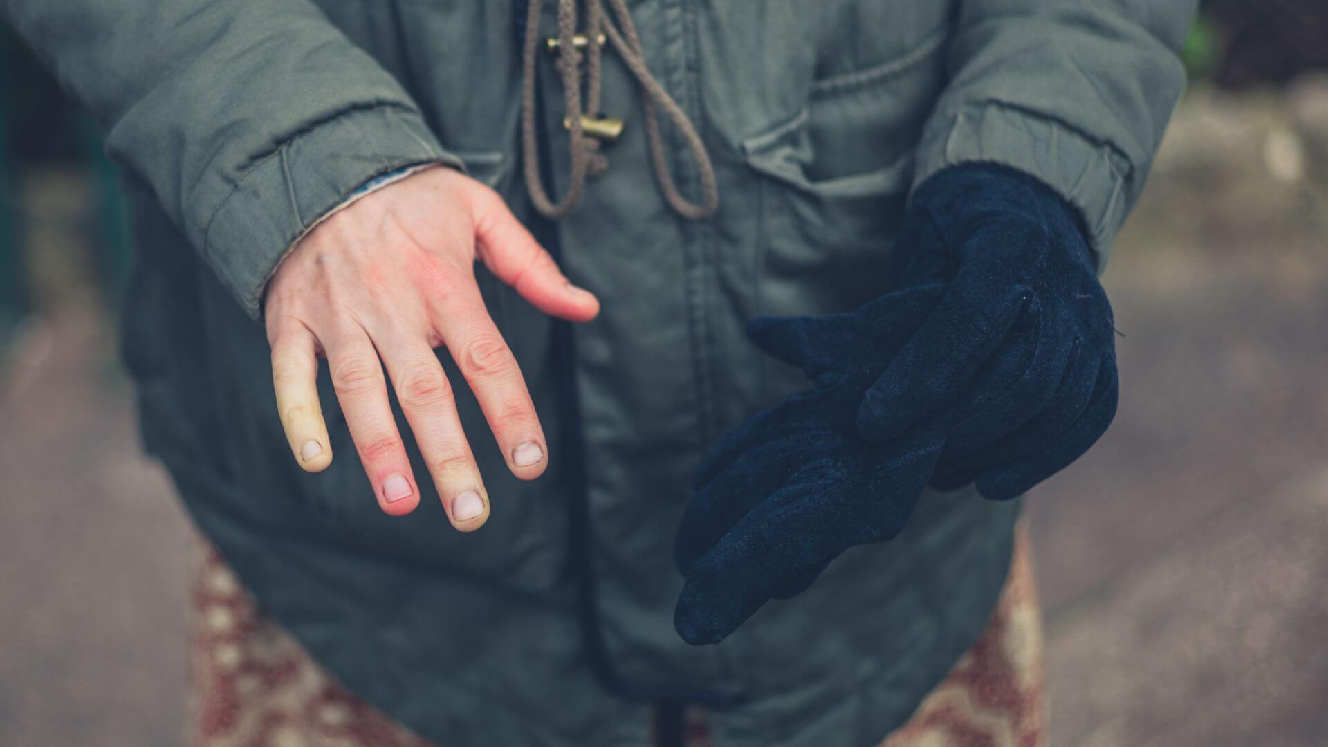 Raynauds Phenomenon Compensation