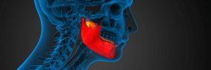 broken jaw compensation