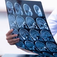 brain-injury-hero