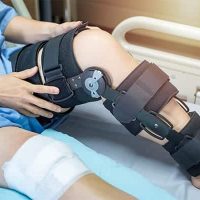 leg injury claims